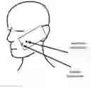 Fig. 01 - Microphone array subset selection for robust noise reduction