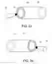 Fig. 04 - Listening device adapted for establishing an electric connection to an external device using electrically conductive parts of one or more components of the listening device