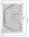 Fig. 09 - Split magnet loudspeaker