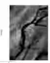 Fig. 08 - Automated system for anatomical vessel characteristic determination