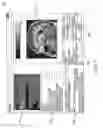 Fig. 08 - SYSTEM AND METHOD FOR ANALYZING AND VISUALIZING LOCAL CLINICAL FEATURES