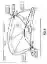 Fig. 06 - Bandwidth defragmentation systems and methods in optical networks
