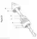 Fig. 22 - Seismic tool assembly for use in anchor insertion