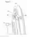 Fig. 05 - Turbomachine actuation system and method