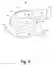 Fig. 06 - Turbine housing assembly
