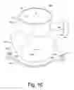 Fig. 11 - Turbine housing assembly