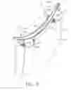 Fig. 06 - Composite vane mounting