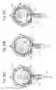 Fig. 22 - Compressor with liquid injection cooling