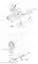 Fig. 04 - Syringe actuating method and assembly