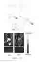 Fig. 02 - Imaging probes, methods of making imaging probes, and methods of imaging