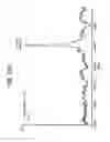 Fig. 47 - FGF21 MUTANTS AND USES THEREOF