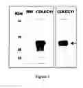 Fig. 02 - TUMOR MARKERS AND METHODS OF USE THEREOF
