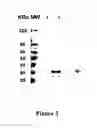 Fig. 04 - TUMOR MARKERS AND METHODS OF USE THEREOF