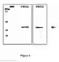 Fig. 05 - TUMOR MARKERS AND METHODS OF USE THEREOF