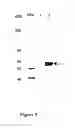 Fig. 10 - TUMOR MARKERS AND METHODS OF USE THEREOF