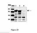 Fig. 11 - TUMOR MARKERS AND METHODS OF USE THEREOF