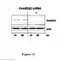 Fig. 12 - TUMOR MARKERS AND METHODS OF USE THEREOF