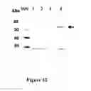 Fig. 13 - TUMOR MARKERS AND METHODS OF USE THEREOF