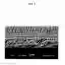 Fig. 09 - ADHESIVE STRUCTURE WITH STIFF PROTRUSIONS ON ADHESIVE SURFACE