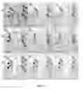 Fig. 19 - Flexible Microfluidic Device with Interconnected Porous Network