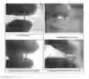 Fig. 01 - Medical device coatings