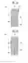 Fig. 05 - Battery array and battery pack having the same