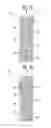 Fig. 10 - Battery array and battery pack having the same