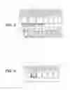 Fig. 03 - Device and Method for Capturing Dental Records