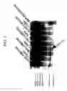 Fig. 08 - METHODS OF DIAGNOSING CERVICAL CANCER