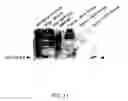 Fig. 12 - METHODS OF DIAGNOSING CERVICAL CANCER