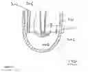Fig. 13 - Sperm separation system
