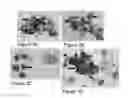 Fig. 04 - Identification of high grade or ≧ CIN2 for early stages and late stages detection, screening, and diagnosis of human papillomavirus (HPV) and HPV-associated cancers