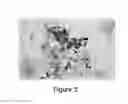 Fig. 06 - Identification of high grade or ≧ CIN2 for early stages and late stages detection, screening, and diagnosis of human papillomavirus (HPV) and HPV-associated cancers