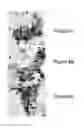 Fig. 07 - Identification of high grade or ≧ CIN2 for early stages and late stages detection, screening, and diagnosis of human papillomavirus (HPV) and HPV-associated cancers