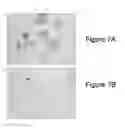 Fig. 08 - Identification of high grade or ≧ CIN2 for early stages and late stages detection, screening, and diagnosis of human papillomavirus (HPV) and HPV-associated cancers