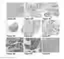 Fig. 10 - Identification of high grade or ≧ CIN2 for early stages and late stages detection, screening, and diagnosis of human papillomavirus (HPV) and HPV-associated cancers