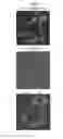Fig. 04 - Methods For Whole-Cell Analysis Of Gram-Positive Bacteria