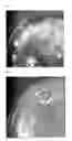 Fig. 04 - METHOD FOR PRODUCING SELECTIVE MEDIUM AND USE THEREOF