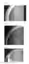 Fig. 10 - METHOD FOR PRODUCING SELECTIVE MEDIUM AND USE THEREOF