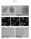 Fig. 06 - ENUCLEATION OF CELLS WITH PSORALENS