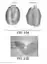 Fig. 22 - Anti-VEGF-C antibodies and methods using same