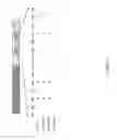 Fig. 02 - Method for controlling the biological activity of a protein in a vertebrate cell