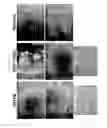 Fig. 27 - Method for making IPS cells