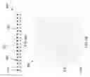 Fig. 09 - Leadless array plastic package with various IC packaging configurations