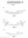 Fig. 03 - BRAS, INSERTS, AND UNDERWIRES, AND METHODS OF FORMING SUCH BRAS, INSERTS, AND UNDERWIRES