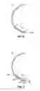 Fig. 04 - BRAS, INSERTS, AND UNDERWIRES, AND METHODS OF FORMING SUCH BRAS, INSERTS, AND UNDERWIRES