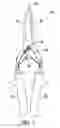 Fig. 03 - Bird debreasting tool and methods