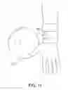Fig. 08 - NO THUMB RELEASE