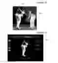 Fig. 20 - Wireless and visual hybrid motion capture system