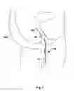 Fig. 02 - METHOD AND APPARATUS FOR EXERCISING PELVIC FLOOR MUSCLES